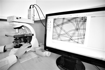 顯微鏡下，聚酯纖維很光亮，表面有斑點(diǎn)，粗細(xì)非常均勻。