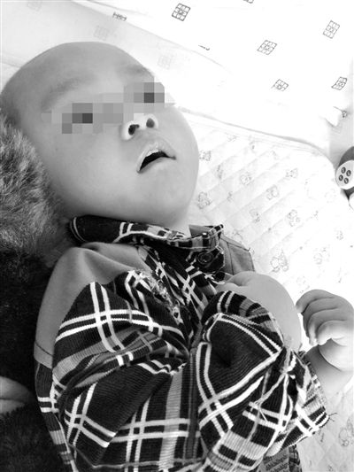 9月10日，陳揚(yáng)躺在醫(yī)院的病床上，他的眼睛仍然沒有聚焦感。新京報(bào)記者 朱柳笛 攝