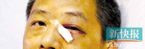 ■這起醫(yī)鬧事件，受傷的遠(yuǎn)遠(yuǎn)不只是熊旭明醫(yī)生的身體。