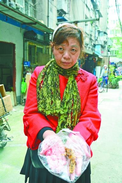 頭部受傷的黃女士展示兩根大魚刺。