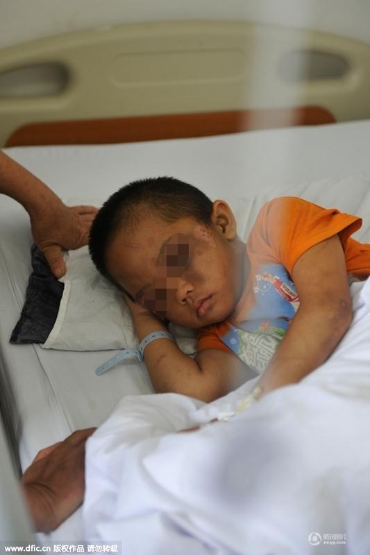 圖為全身傷痕累累的小進。