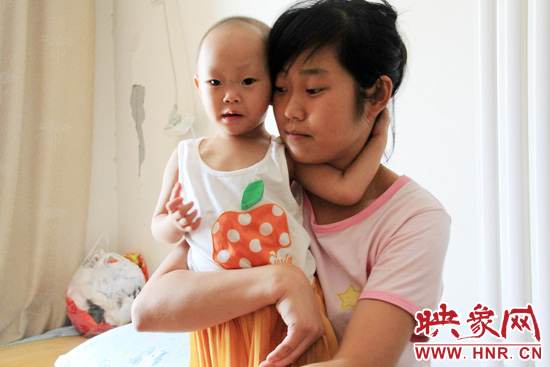 孩子和媽媽在一起，她的右眼已經(jīng)失明。