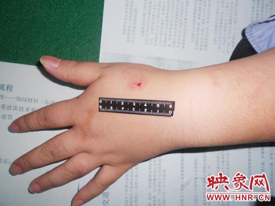 為幫助無證駕駛的朋友逃避處罰，新鄉(xiāng)的王某竟對(duì)執(zhí)勤民警大打出手，還將一名民警的手臂咬傷