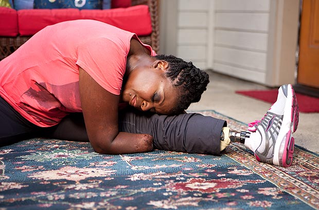 愛(ài)美媽媽整形導(dǎo)致截肢 愛(ài)美媽媽整形導(dǎo)致截肢