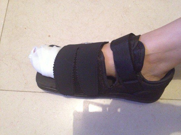 香港女星雨僑誤踢硬物腳趾骨裂錯失角色損失大