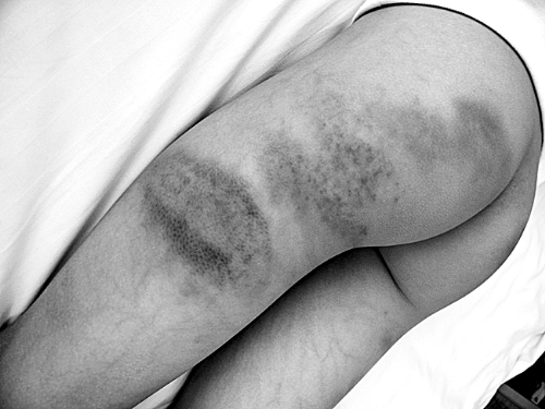 老師持掃帚打學生30分鐘 一個班20個同學被打過 老師持掃帚打學生30分鐘 一個班20個同學被打過