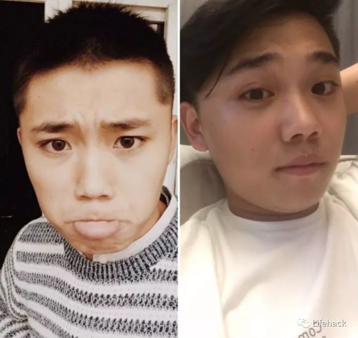 長(zhǎng)胖20斤，臉型怎么變？這些例子看完扎心了！