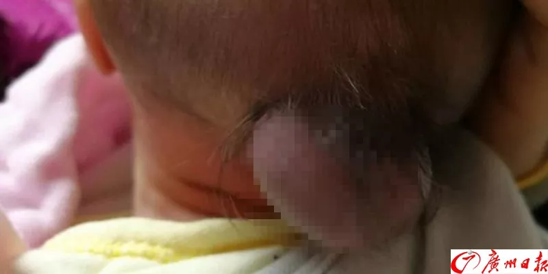 剛出生的男嬰腦袋上長(zhǎng)出尾巴 只因孕媽沒做這事