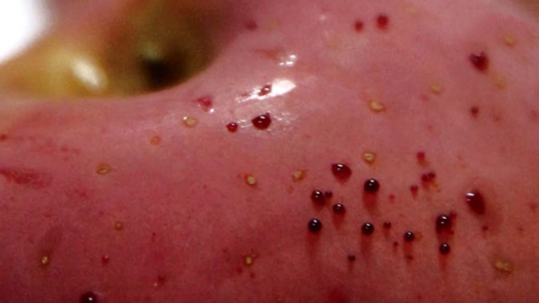 嚇懵！女子用熱水泡蘋果結(jié)果冒出血珠 咋回事？