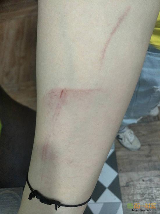 女網(wǎng)友舉報網(wǎng)帖中出示的被打后照片。