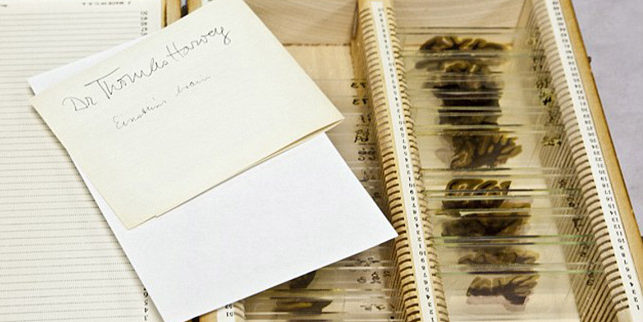 愛(ài)因斯坦大腦切片