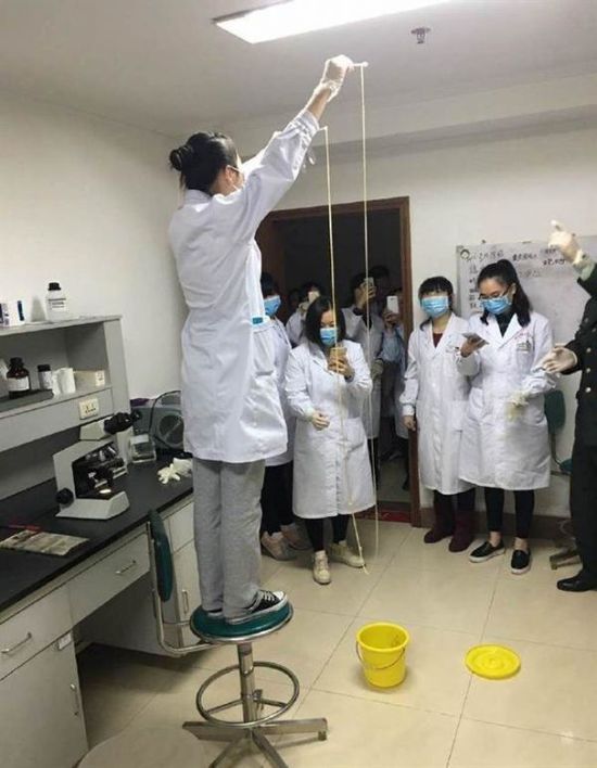 愛吃生肉惹的禍！男子體內(nèi)取出5米長寄生蟲(圖)