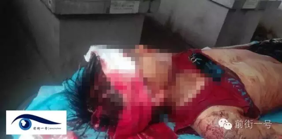 小山頭部受傷嚴(yán)重 小山頭部受傷嚴(yán)重