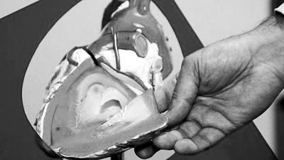 威廉斯領(lǐng)導的研究團隊已經(jīng)利用人體脂肪干細胞，成功3D打印出心臟血管和心臟瓣膜，待一顆心臟的所有部件打