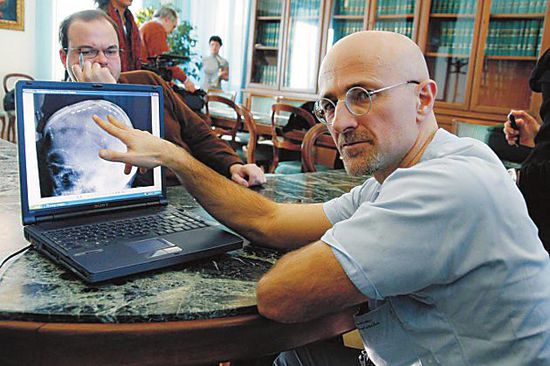 圖為卡納維洛醫(yī)生，不少人認(rèn)為他的想法非常瘋狂