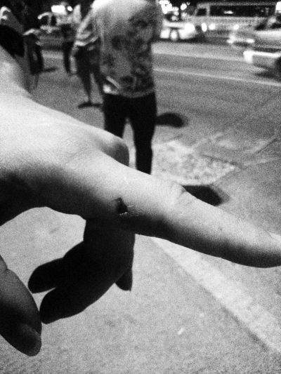 民警食指被咬傷。