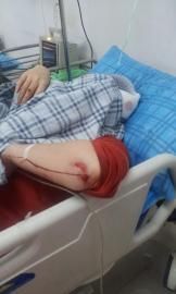 砸窗當(dāng)事人胡女士在醫(yī)院接受治療。