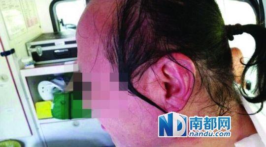 涉事教師遭熱水潑臉后的照片。