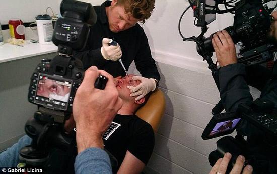 該實(shí)驗(yàn)是由加州一支名為“生物駭客”的實(shí)驗(yàn)團(tuán)隊(duì)開展的。他們使用了一種名為二氫卟吩e6（Ce6）的物質(zhì)的溶液。Ce6常見于深海魚體內(nèi)，有光敏特性，通常用于癌癥治療研究中。研究團(tuán)隊(duì)將Ce6與胰島素和鹽水混合起來，得到一種溶液，可以在低光照條件下提高人類的視力。