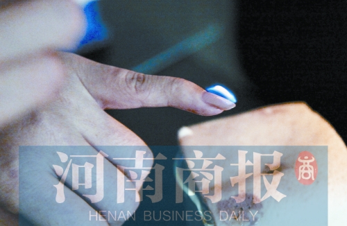 將指甲油涂在指甲上，靠近火焰時被引燃了