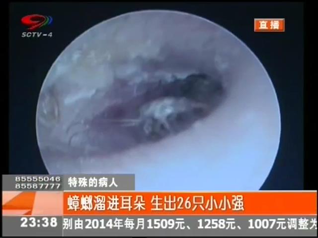 小強(qiáng)溜進(jìn)耳朵？生26只小小強(qiáng)