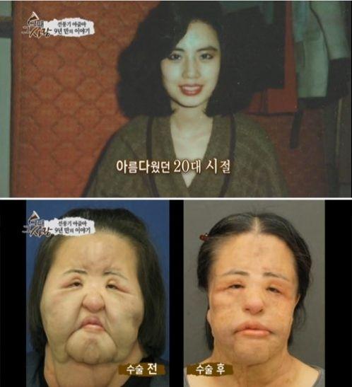 美女整容變“電風(fēng)扇大媽” 盤點整容失敗驚悚案例