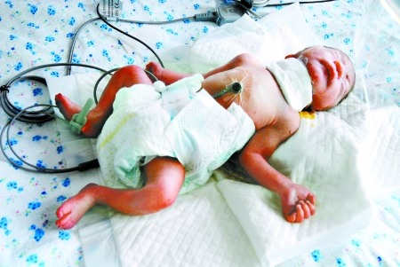 遼寧鞍山女嬰慘遭割喉遺棄 遼寧鞍山女嬰慘遭割喉遺棄